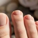 11 Toe Nails: Tips, Trends, and Care for Healthy, Beautiful Feet